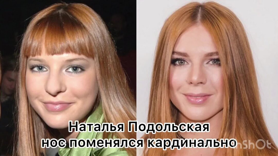 Подольская после операции
