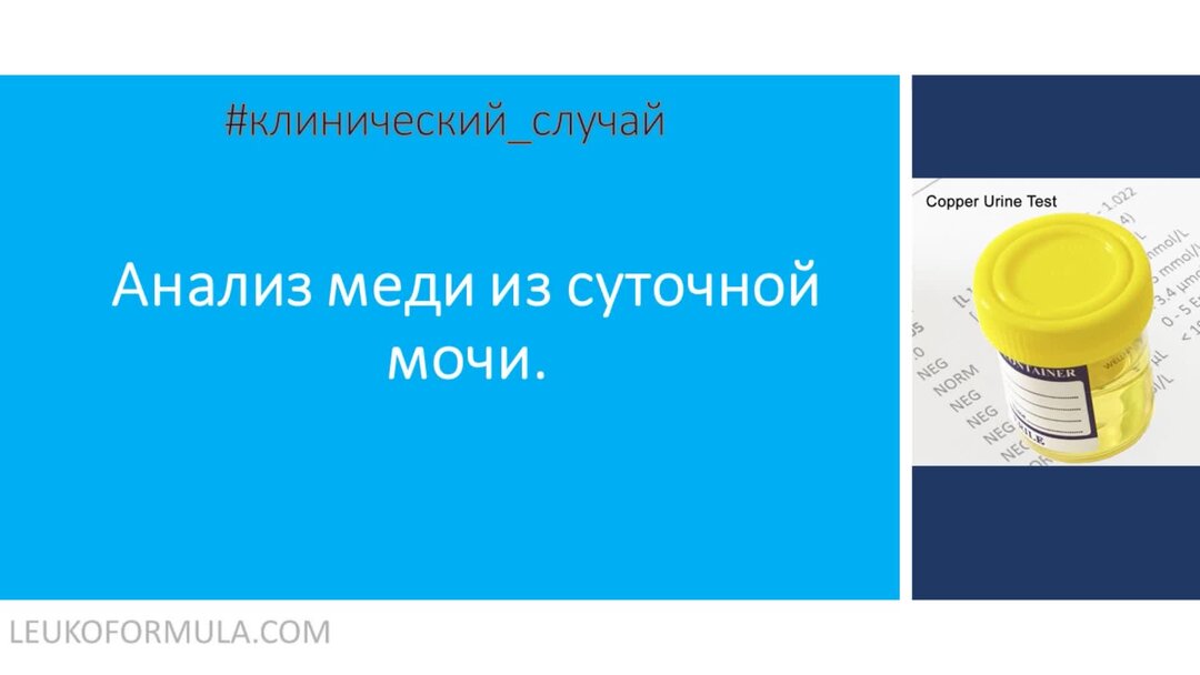 Анализ медный