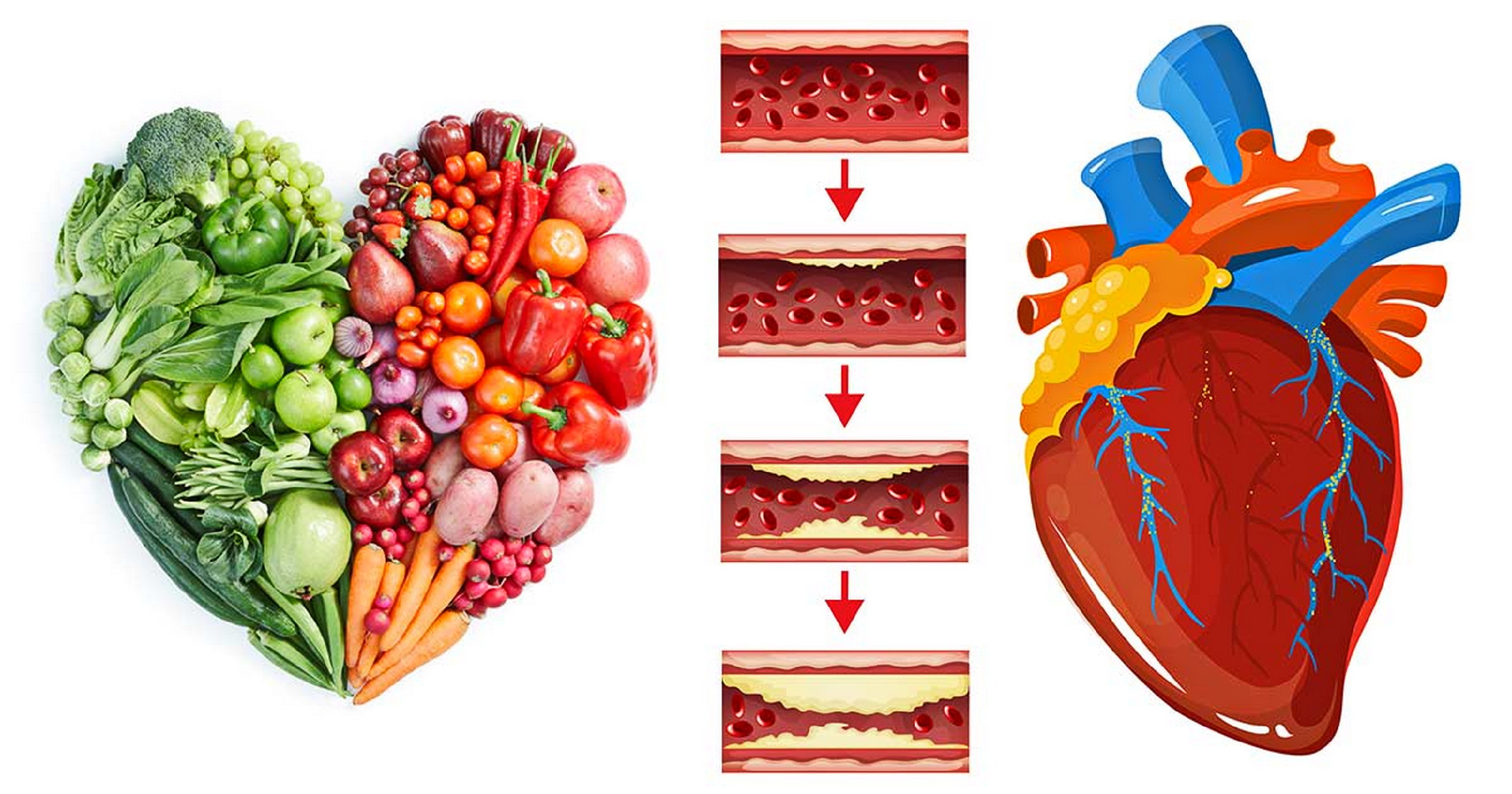Холестерин и сердце
