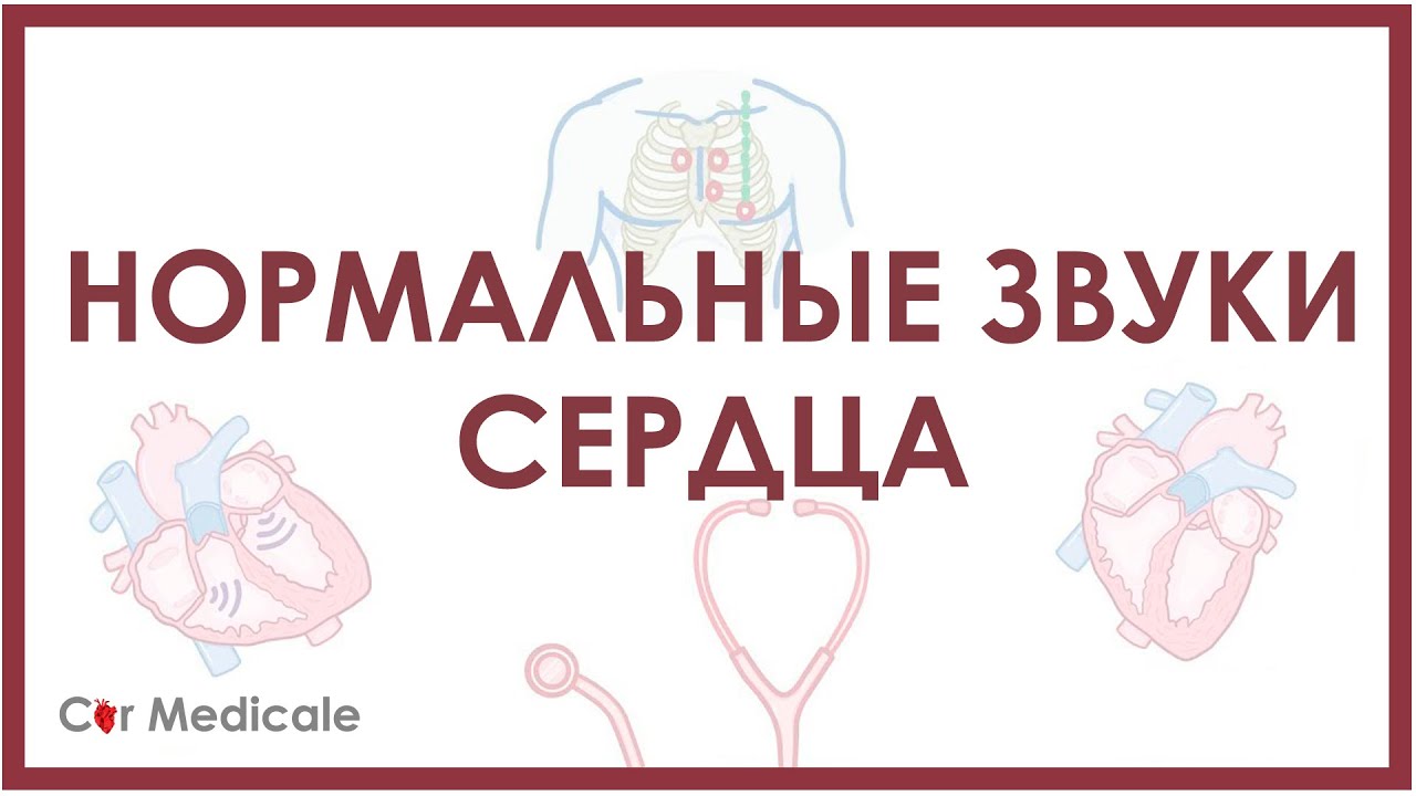 Звуки остановитесь. Звук сердца. Сердечные звуки s1. Звуки при аускультации сердца. Звуковые сердца