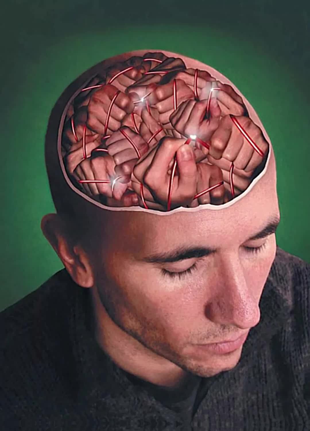 Brain head