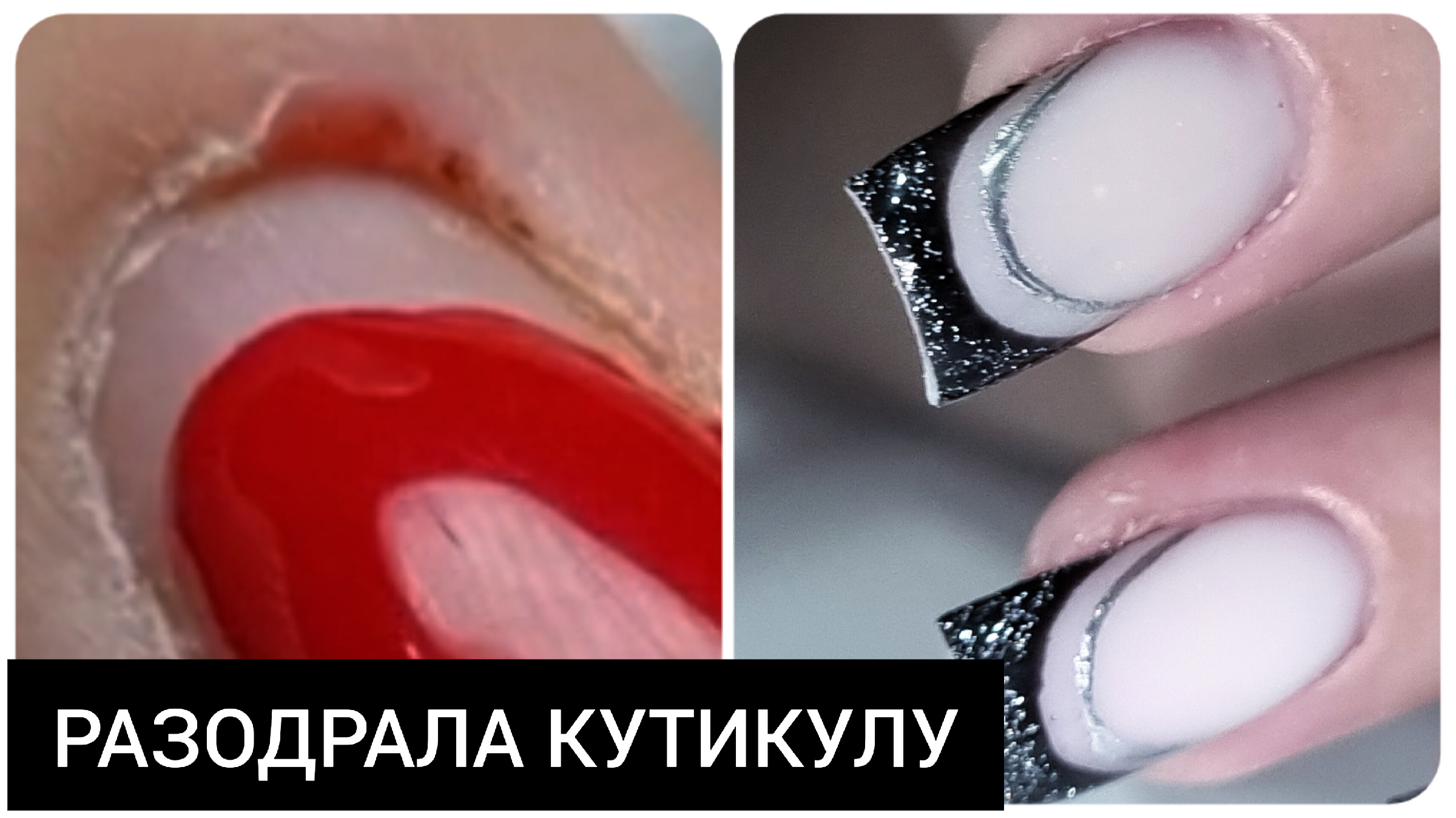 Исправление формы ногтей