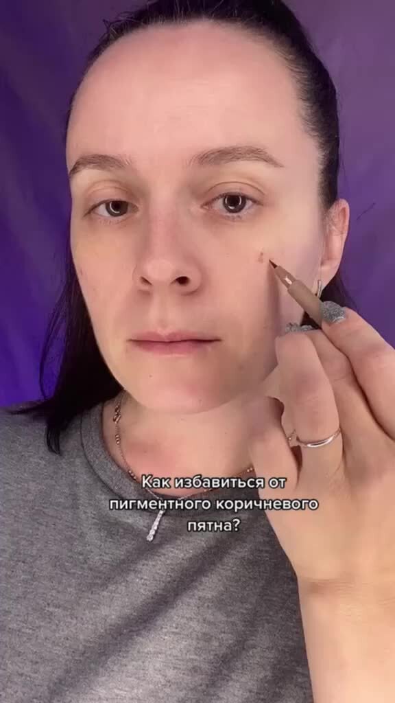 Пигментные пятна на скулах. Как замаскировать пигментные. Гиперпигментация на лице. Тоналка которая замазывает прыщи. Как замаскировать пигментные.