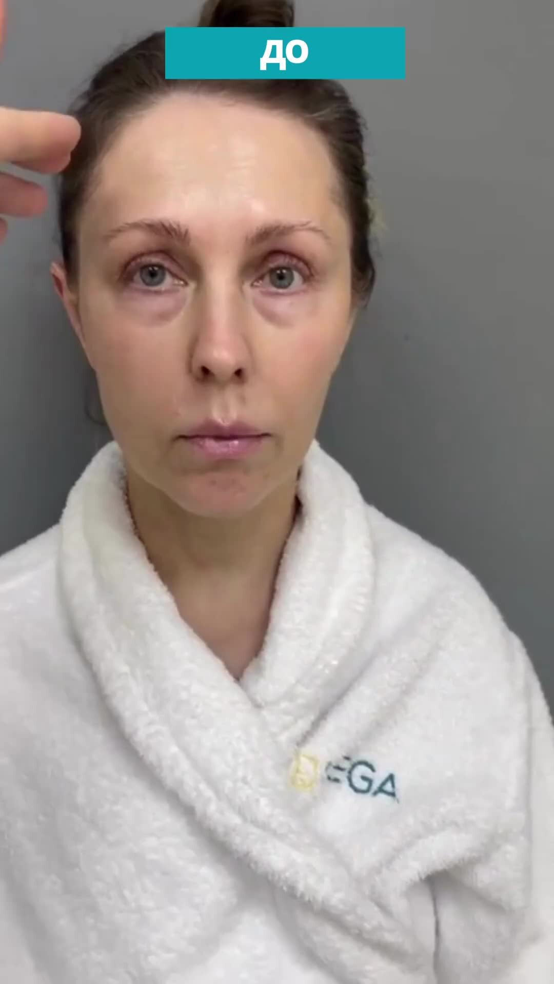 Пластический хирург СПБ l Христенко А.А. | Промежуточный результат ...