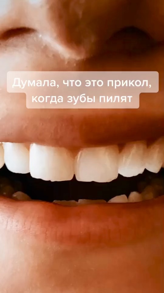 Подпилить передние зубы. Подпиливают ли передние зубы. Подпиливают ли передние зубы. Подпиливание зубов клыки. Подпиливание передних зубов.