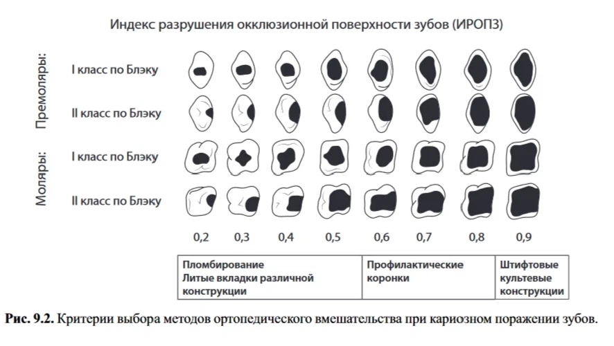 Иропз в стоматологии