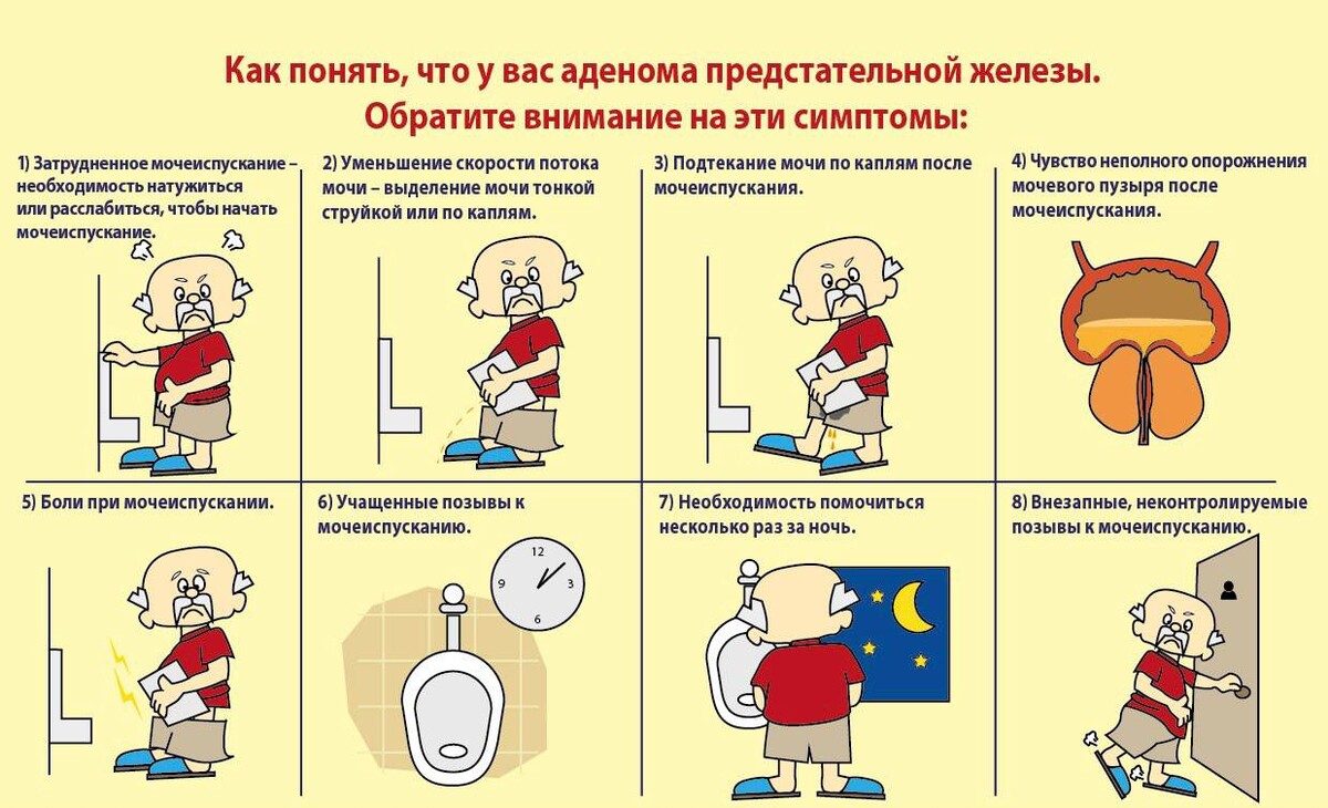 Аденома простаты симптомы