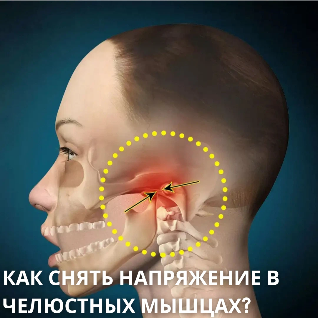 Болит челюсть при открытии возле уха. Артроз челюстно-лицевого сустава. Болевая дисфункция височно-нижнечелюстного сустава.