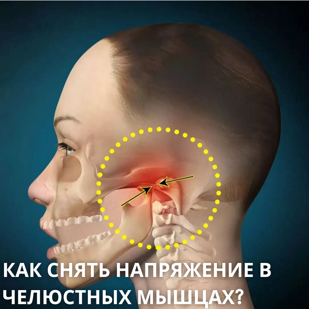 Из за чего может болеть челюсть