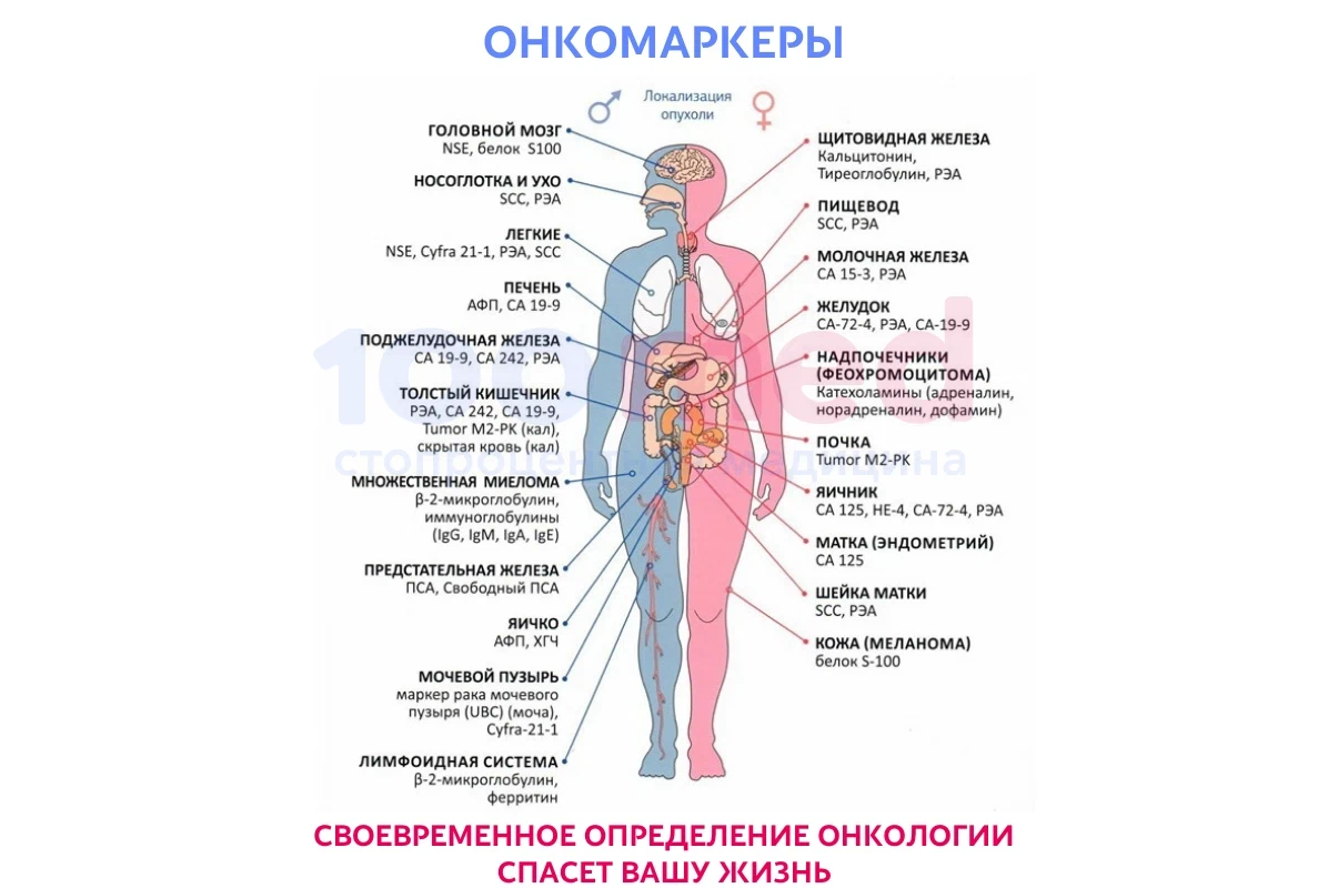 Онкомаркеры картинка. Онкомаркер 125 16 единиц после удаления яичников и матки.