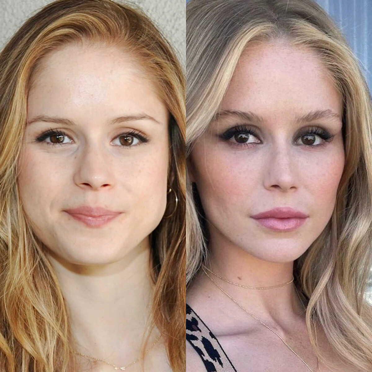 Erin moriarty face surgery