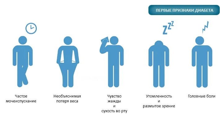 Клиническая картина сд 2 типа