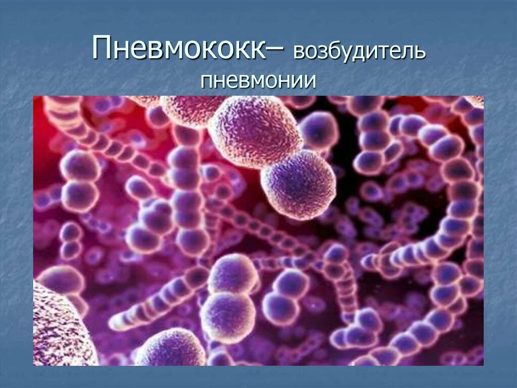 Пневмококковая инфекция картинки