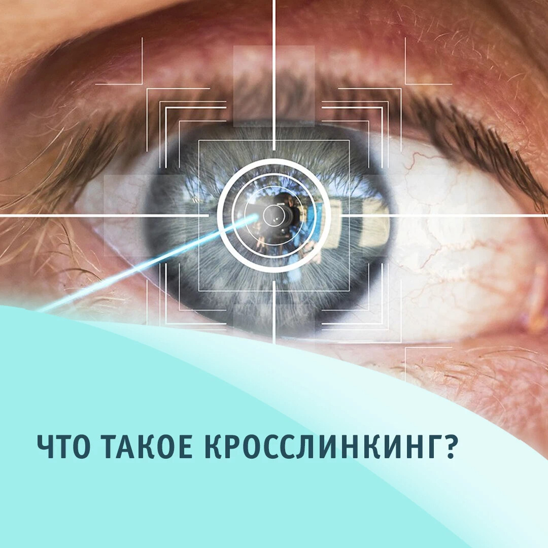 Медицинском центре «офтальмос». Калуга максима горького 63 микрохирургия. Микрохирургия глаза федорова санкт-петербург. Клиника взгляд тула. Мвк микрохирургии глаза адлер.