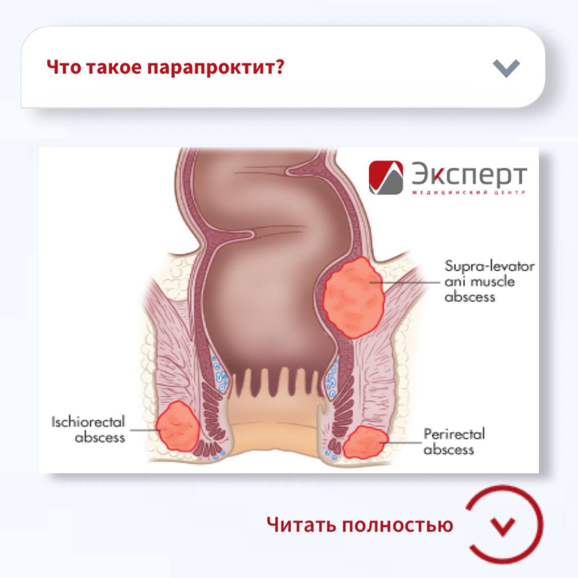 стул после операции парапроктита