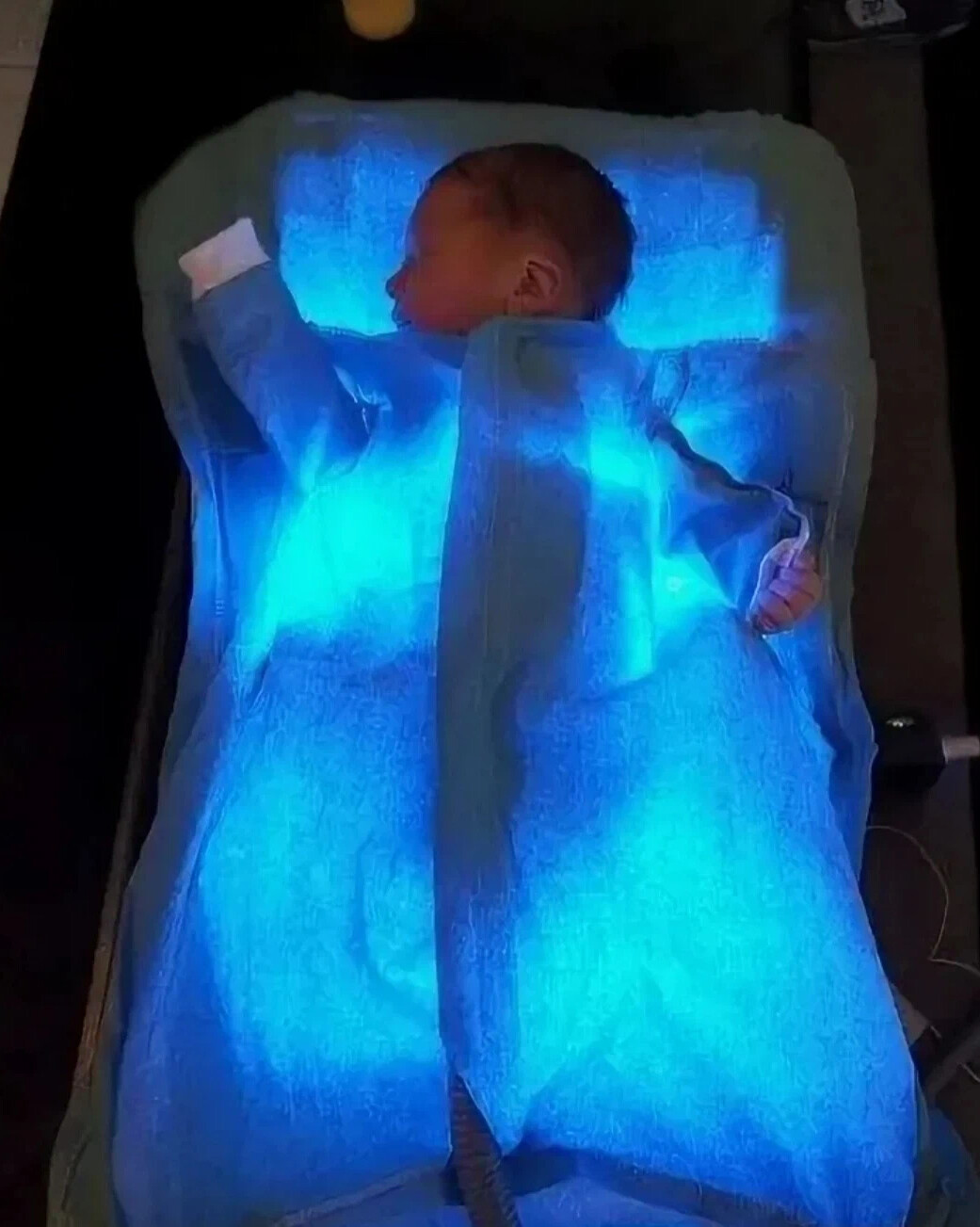 Ультрафиолетовая лампа для новорожденных от желтушки