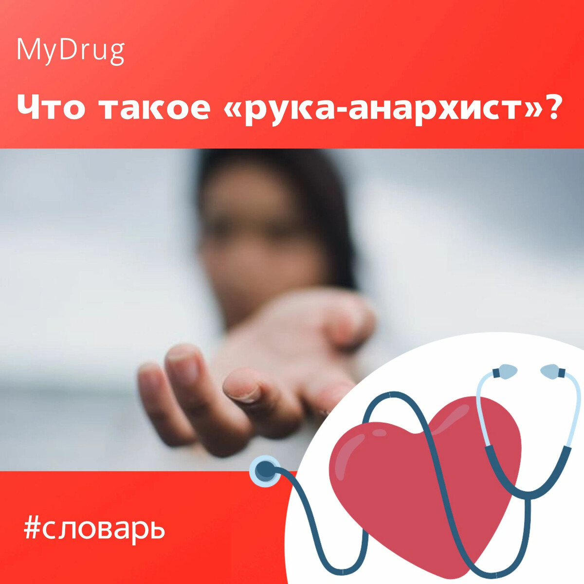 Синдром чужой руки