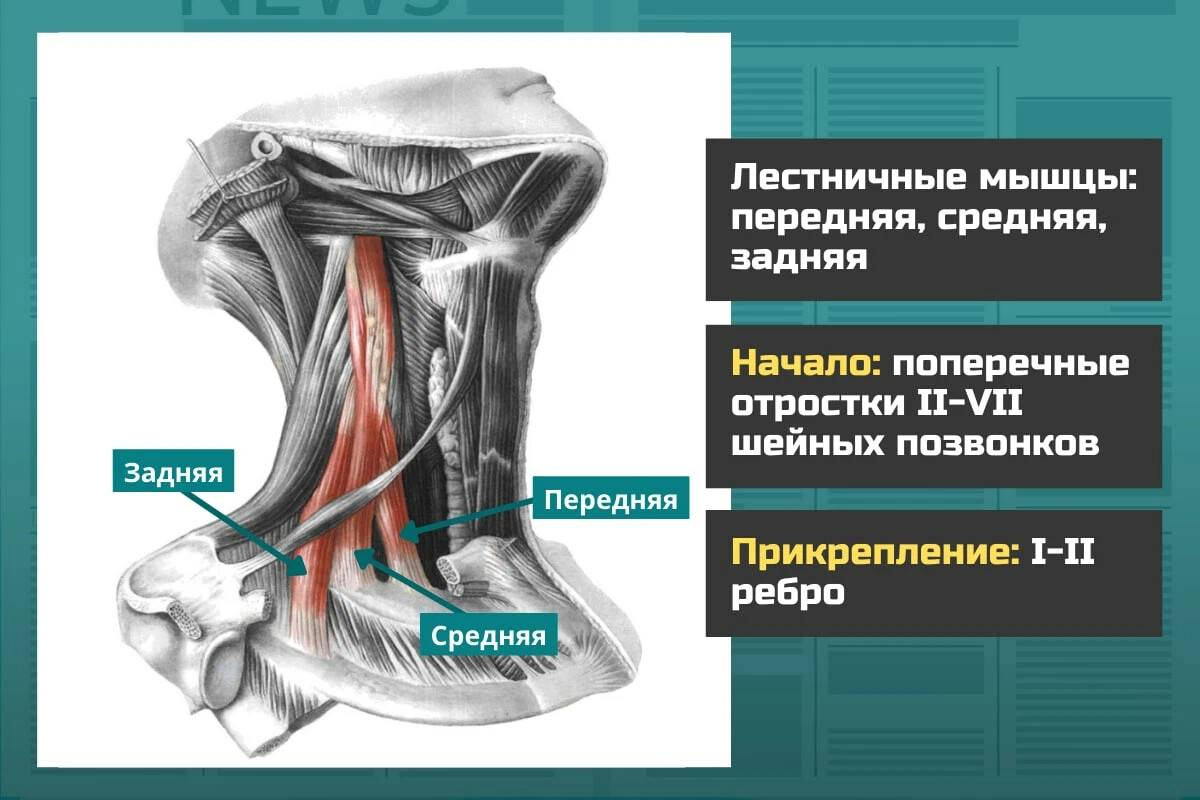 Где находится лестничная мышца у человека картинки