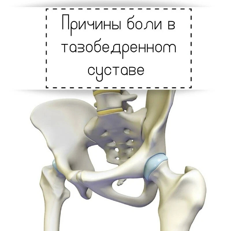 Анализы перед операцией тазобедренного сустава. Боль в тазобедренном суставе. Слабые места тазобедренного сустава. Коха вара тазобедренного сустава. Трещина в тазобедренном суставе.