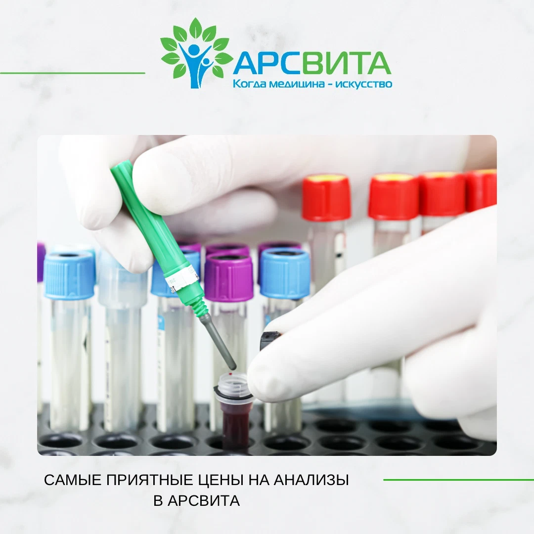 Куда сдавать химию. Лаборатория анализы. Исследование крови. Виды лабораторий для исследования крови. АРСВИТА биохимическое исследование крови АРСВИТА