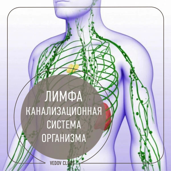 Как выглядит лимфа человека Отеки 