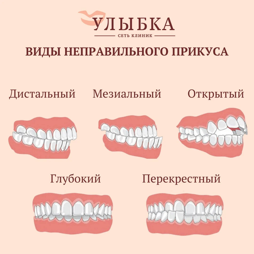 фото правильно поставленных зубов