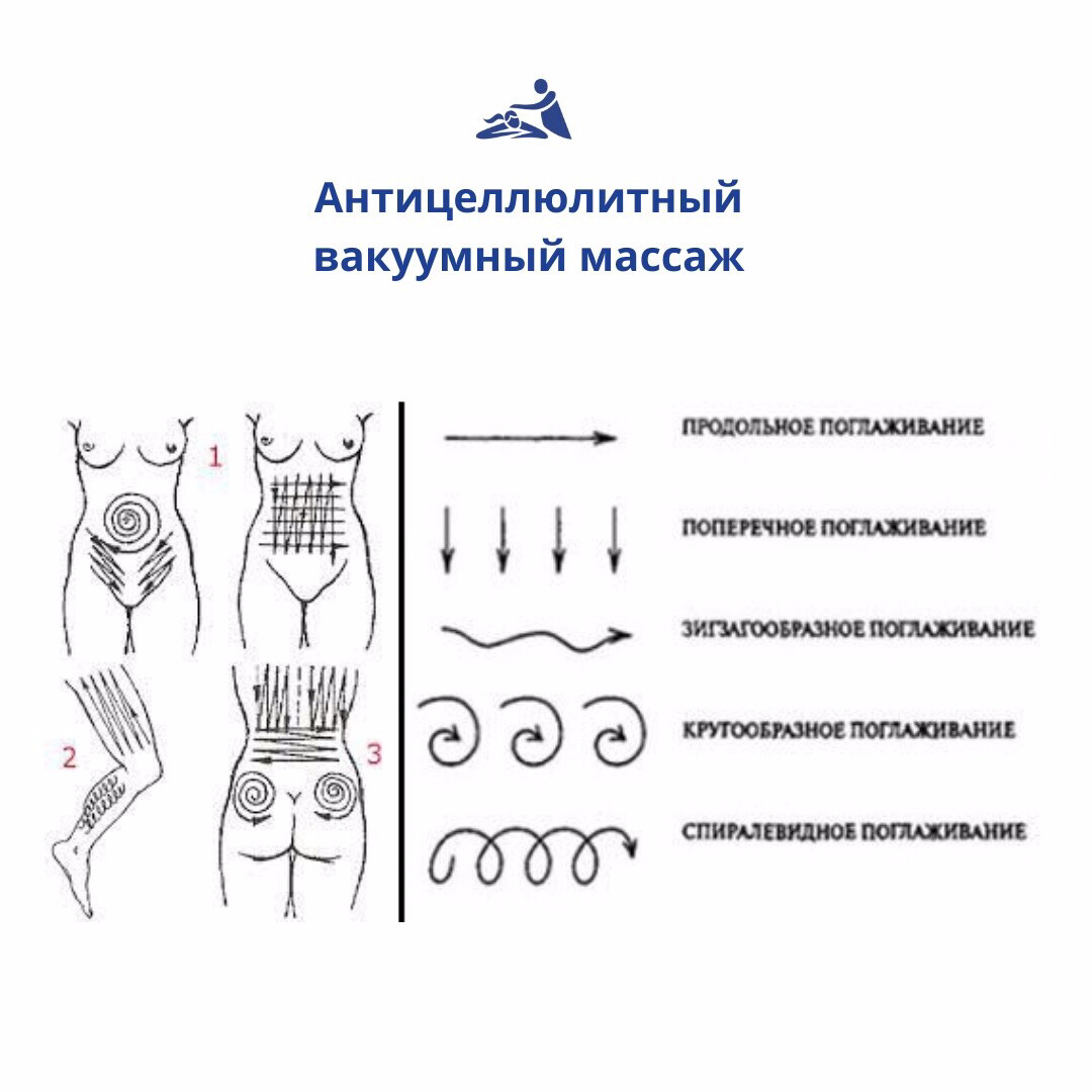 Вакуумный массаж банками схема