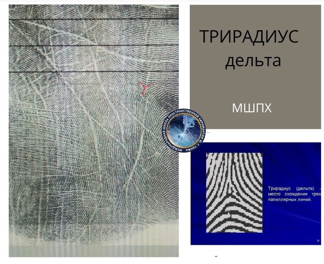 Дельта трирадиус