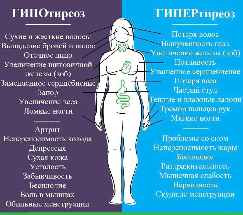 Гипотиреоз фото женщин до и после