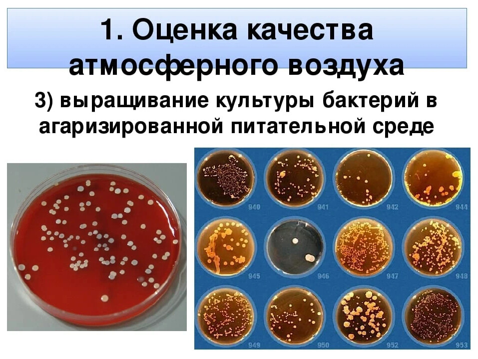 Выращивание микробов на различных питательных средах презентация