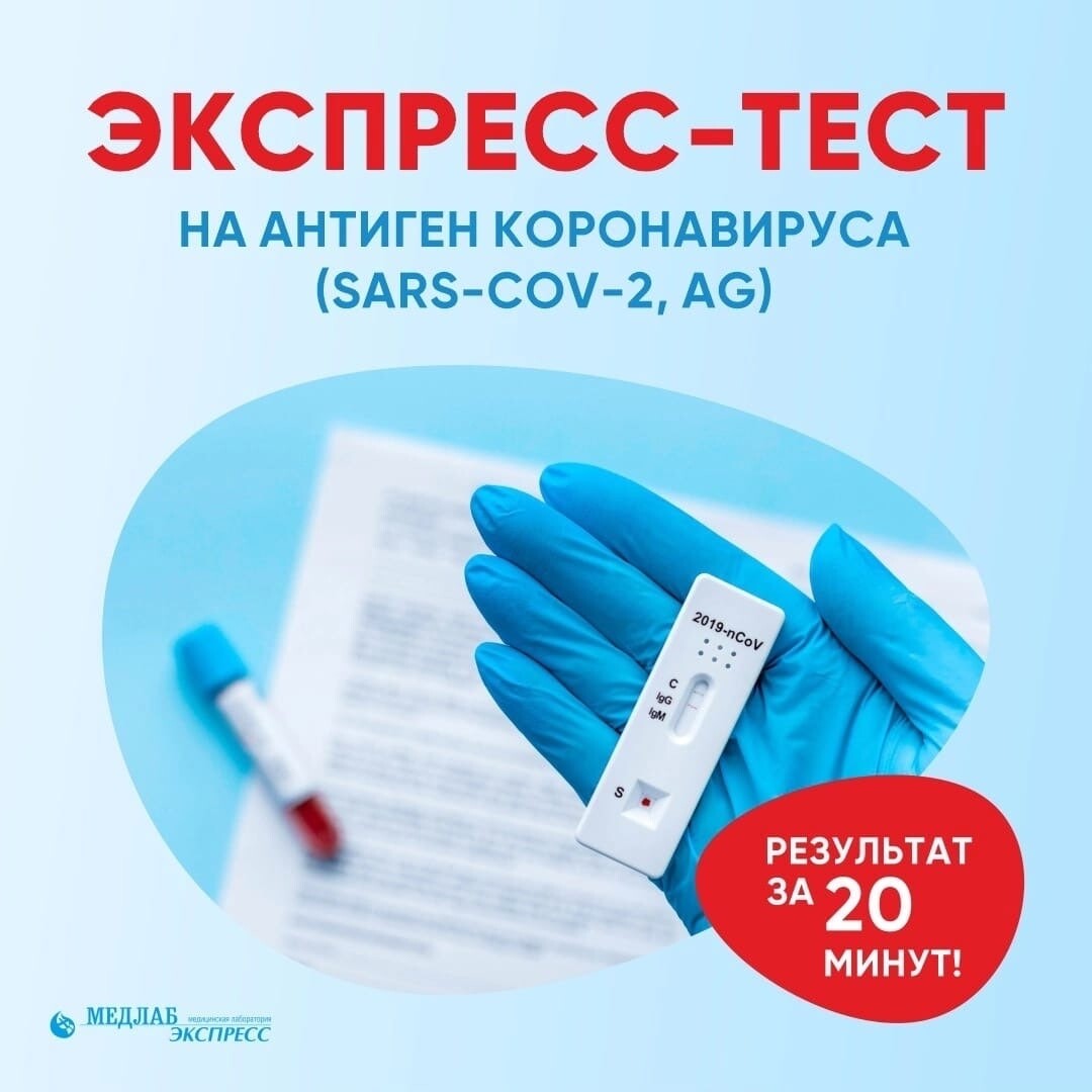 Тест в аэропорту. Экспресс тест на covid. Экспресс пцр тест на коронавирус. Экспресс-тест на covid-19. Сдать экспресс тест на ковид в москве.