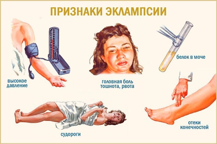 беременная и ноги. беременность. беременные отекшие женщины. судороги у беременной женщины. судороги у беременной женщины.