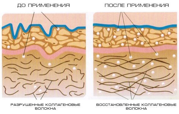 Как выглядит лицо после коллагена