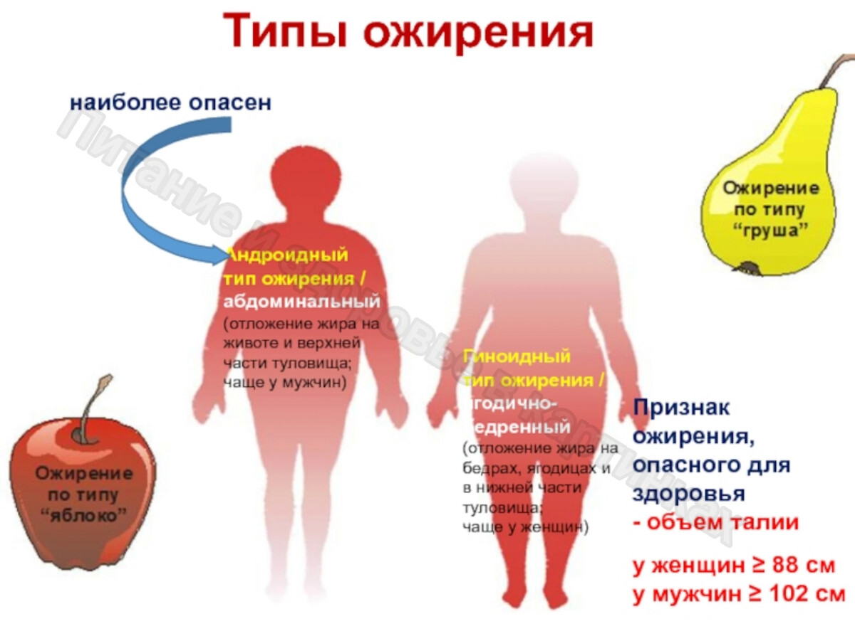 Виды ожирения живота. Алиментарное ожирение 1 степени абдоминальный Тип. Типы ожирения гиноидное и андроидное. Гиноидный Тип ожирения. Типы ожирения по отложению жира.