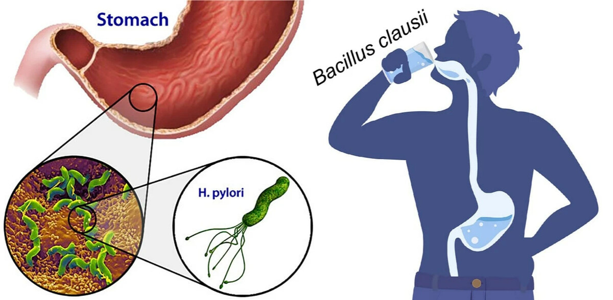 Probiotico helicobacter