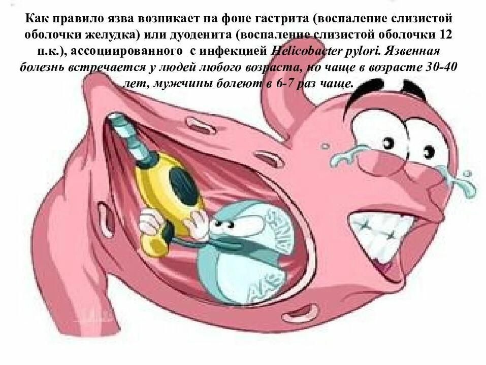 Желудок смешные картинки