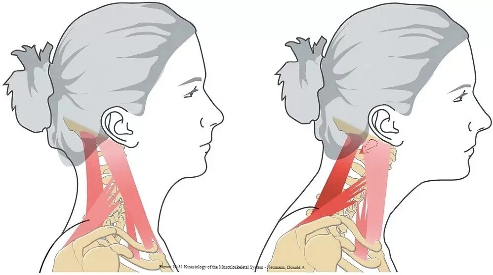 Вытягивание шеи. Вытянутая шея вперед. Forward head posture. Максилла упражнения.