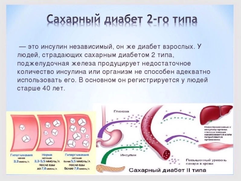 Сахарный диабет 1-го типа. Инсулин при сахарном диабете 1 типа. Сахарный диаебет 2типа.