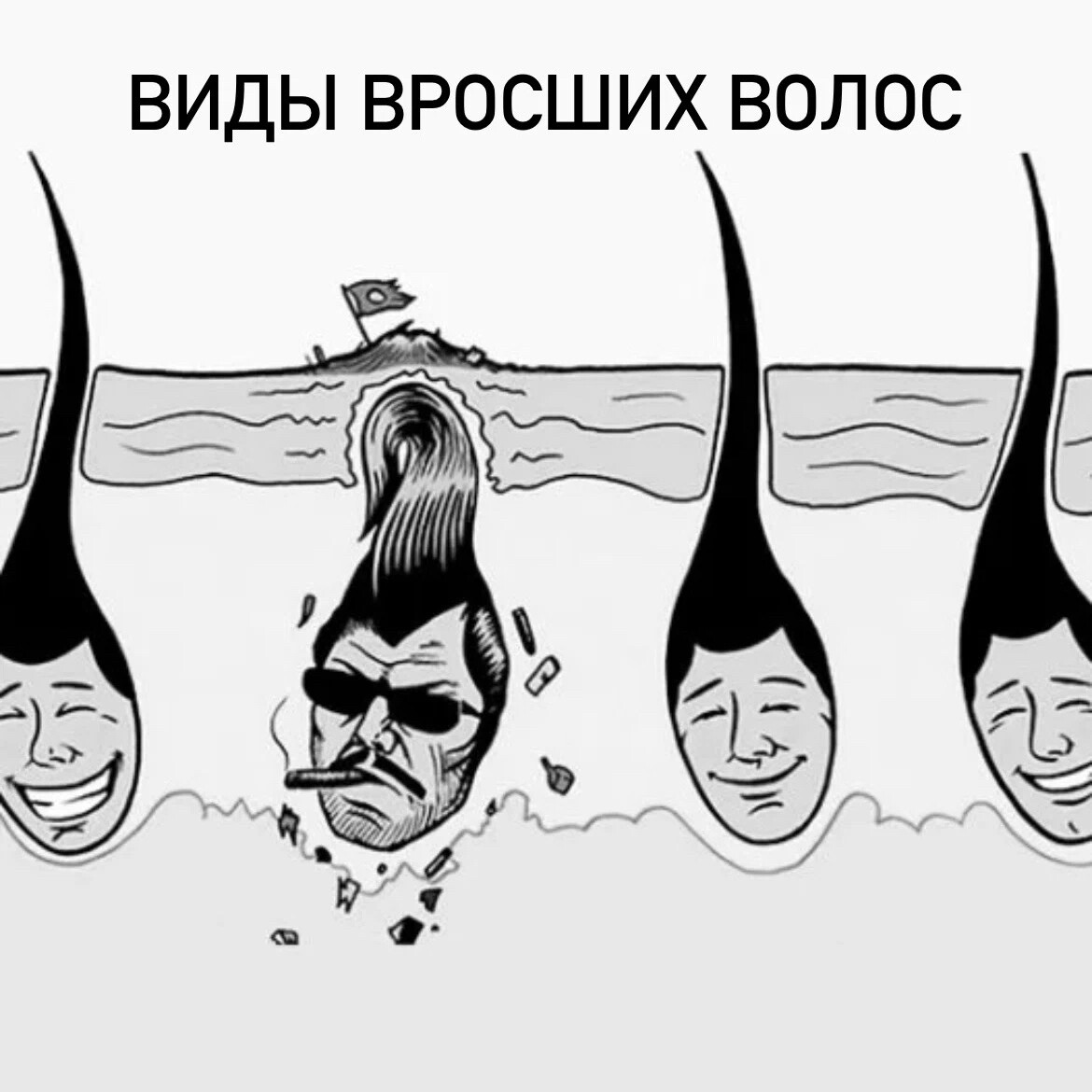 Человек с волосами на голове карикатуры