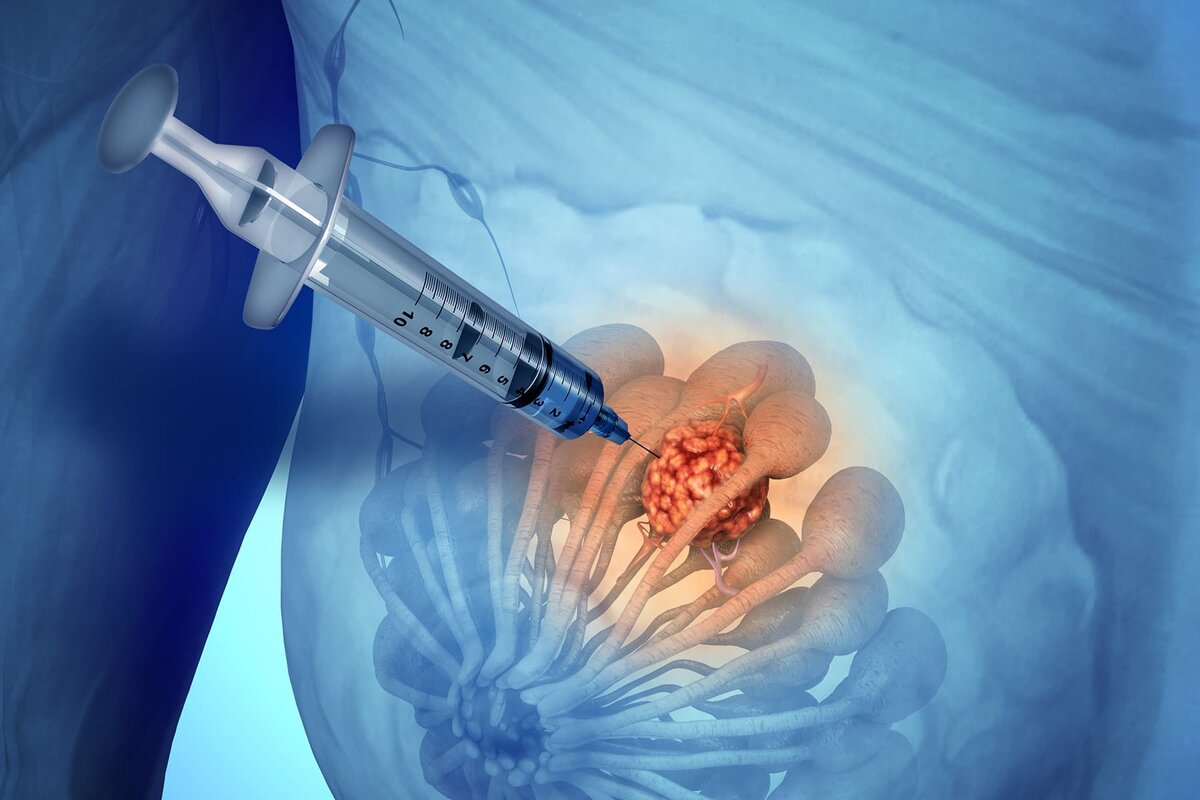 Essential Pediatric Surgery Oncology: The Crucial Doctor Fighting Childhood Cancer