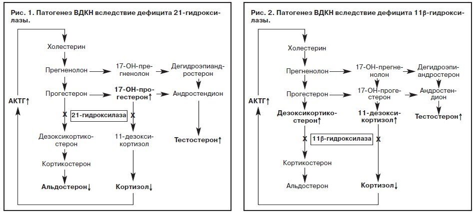 Схема патогенеза врожденной гиперплазии коры надпочечников. Адреногенитальный синдром патогенез схема. Адреногенитальный синдром механизм развития. Врожденная гиперплазия коры надпочечников патогенез.