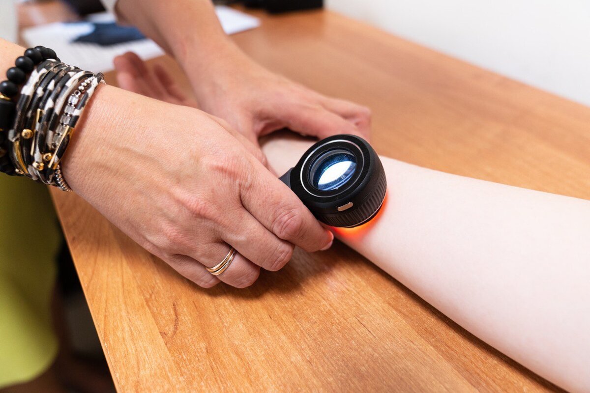 Дерматоскоп. Фото предоставлено пресс-службой Сеченовского Университета