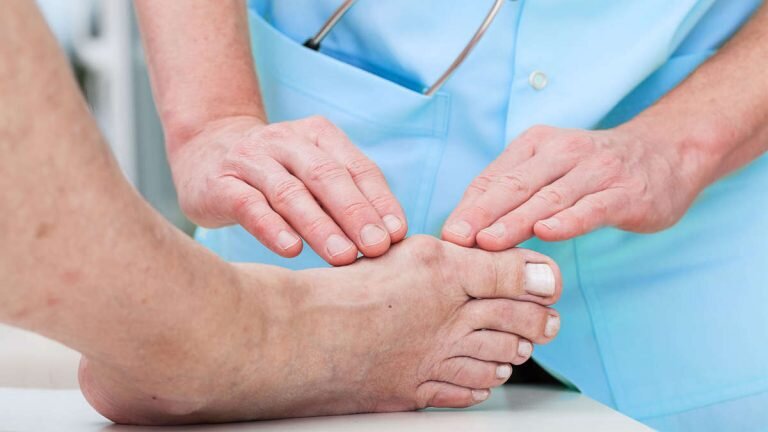 Подагра ног и АЛМАГ Плюс – эффективное лечение в домашних условиях