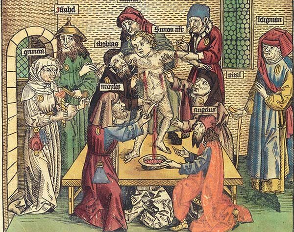 Вымышленный ритуал над Симоном с Тренто в хронике 1493 году.