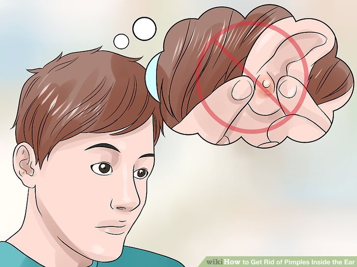 Прыщи могут возникать на ухе, за ухом или внутри ушного канала