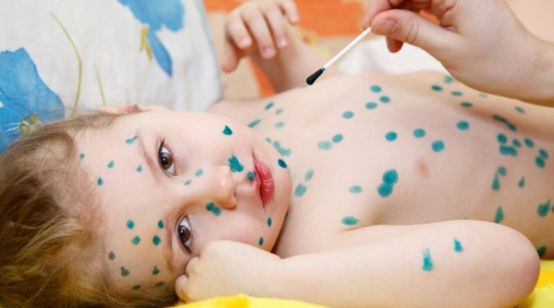 фото взято с сайта kroha.info