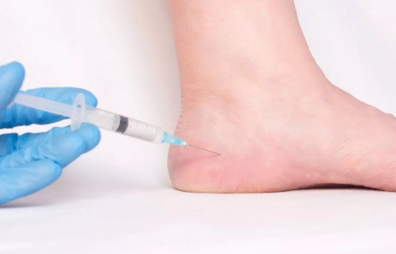 Введение обезболивающего в пятку.