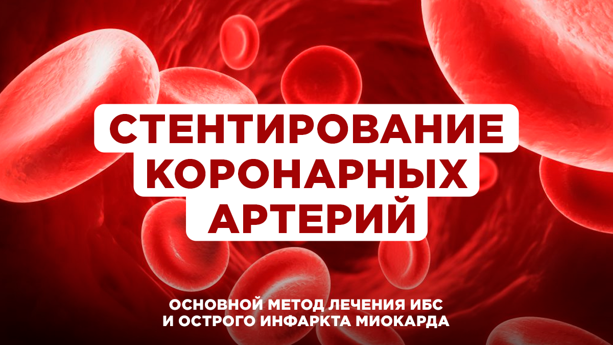 Стентирование коронарных артерий