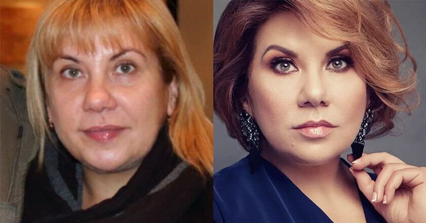Федункив марина фото до и после пластики