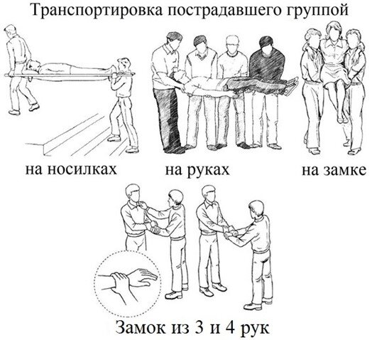 Как правильно использовать спинальный щит?